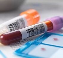 Laboratoire Diagnos vum Prostatitis