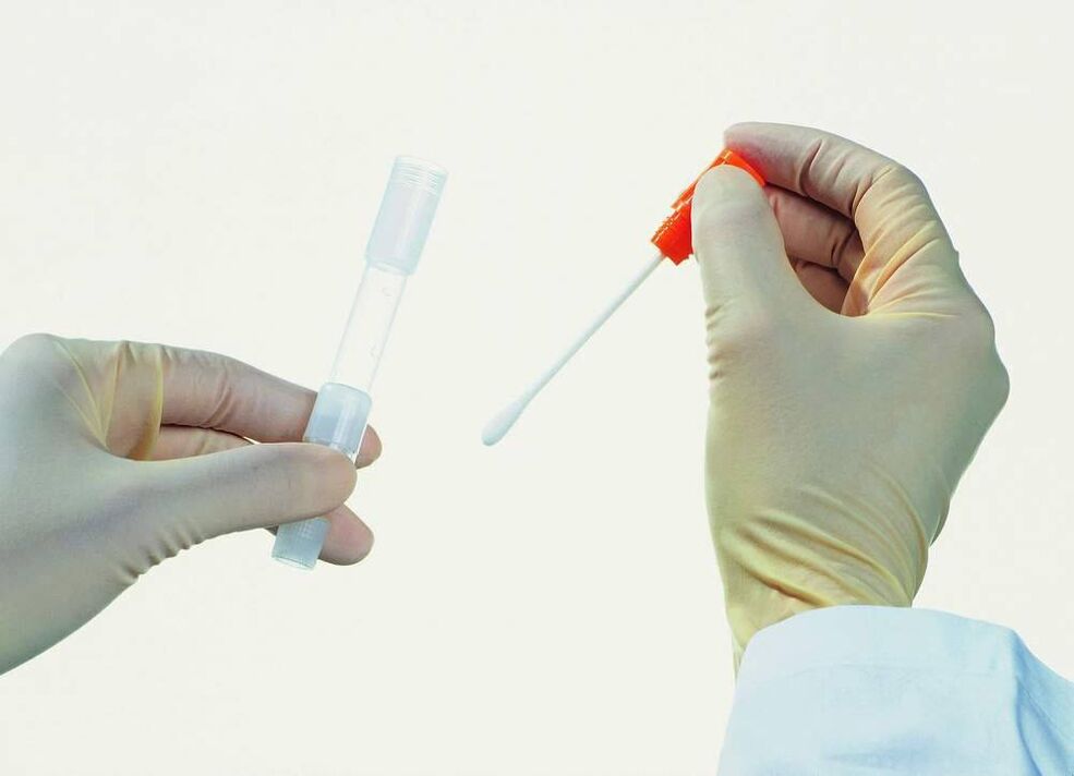 Analyse Sammlung fir chronesch Prostatitis z'entdecken