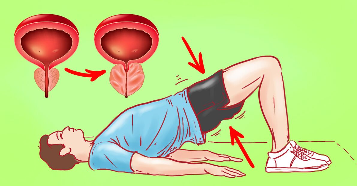 Therapeutesch Übungen fir chronesch Prostatitis
