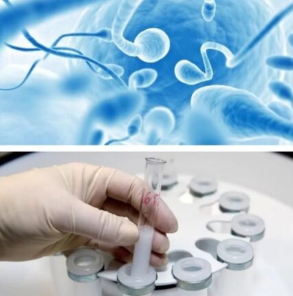 Spermogramm