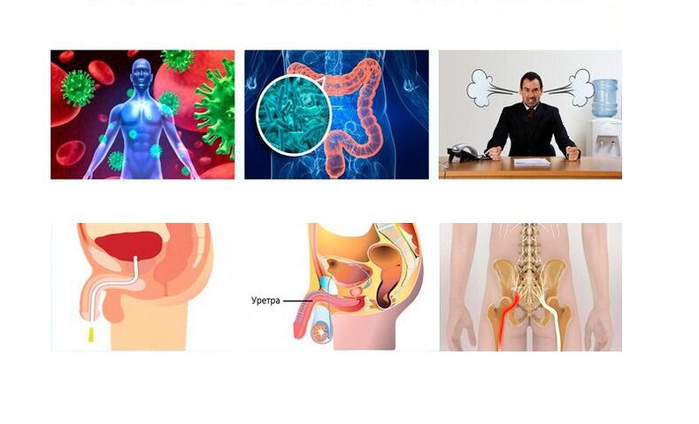 Ursaachen vun Prostatitis